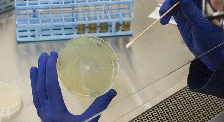 Placa de Petri – TP Laboratorio