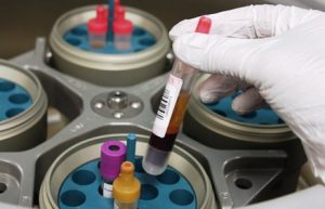 Por ejemplo: en la rama del laboratorio clínico puede ser utilizado para el análisis de la sangre ya que permite separar el plasma de los otros componentes de la sangre. (glóbulos rojos, glóbulos blancos, plaquetas, entre otros).